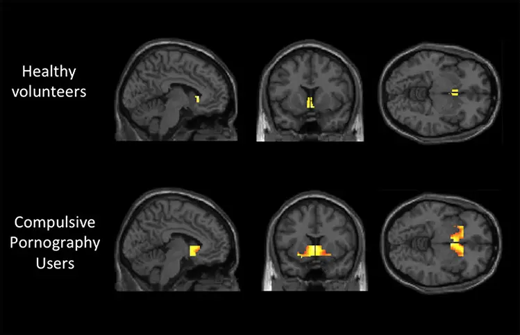 nofap your brain on porn