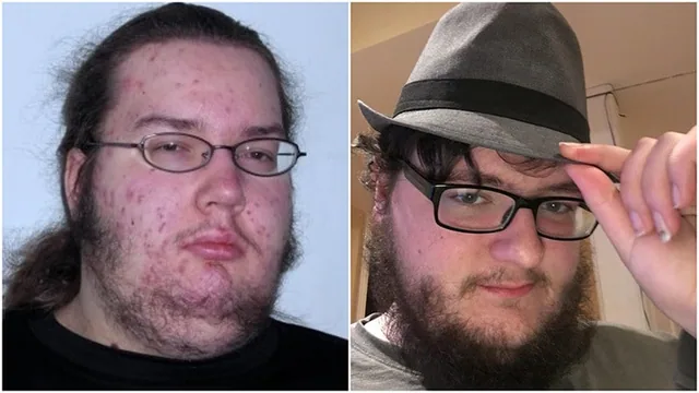 looksmaxing incel
